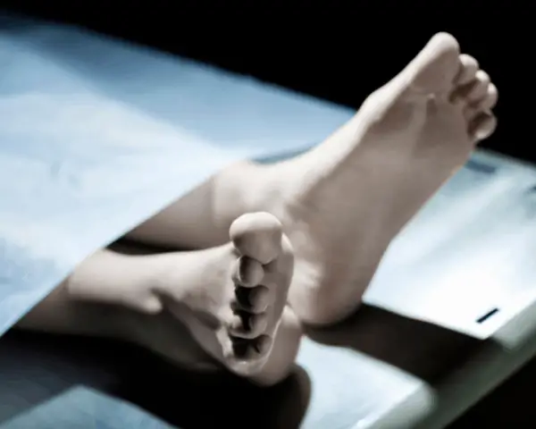 deceased person in morgue